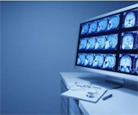 醫(yī)學(xué)影像技術(shù)專業(yè)